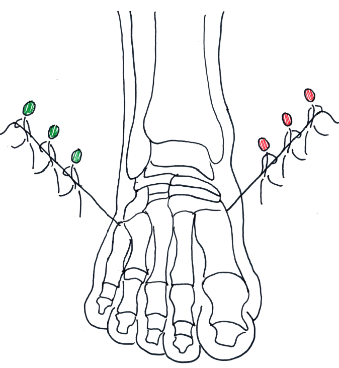 Normal Muscle Balance Foot