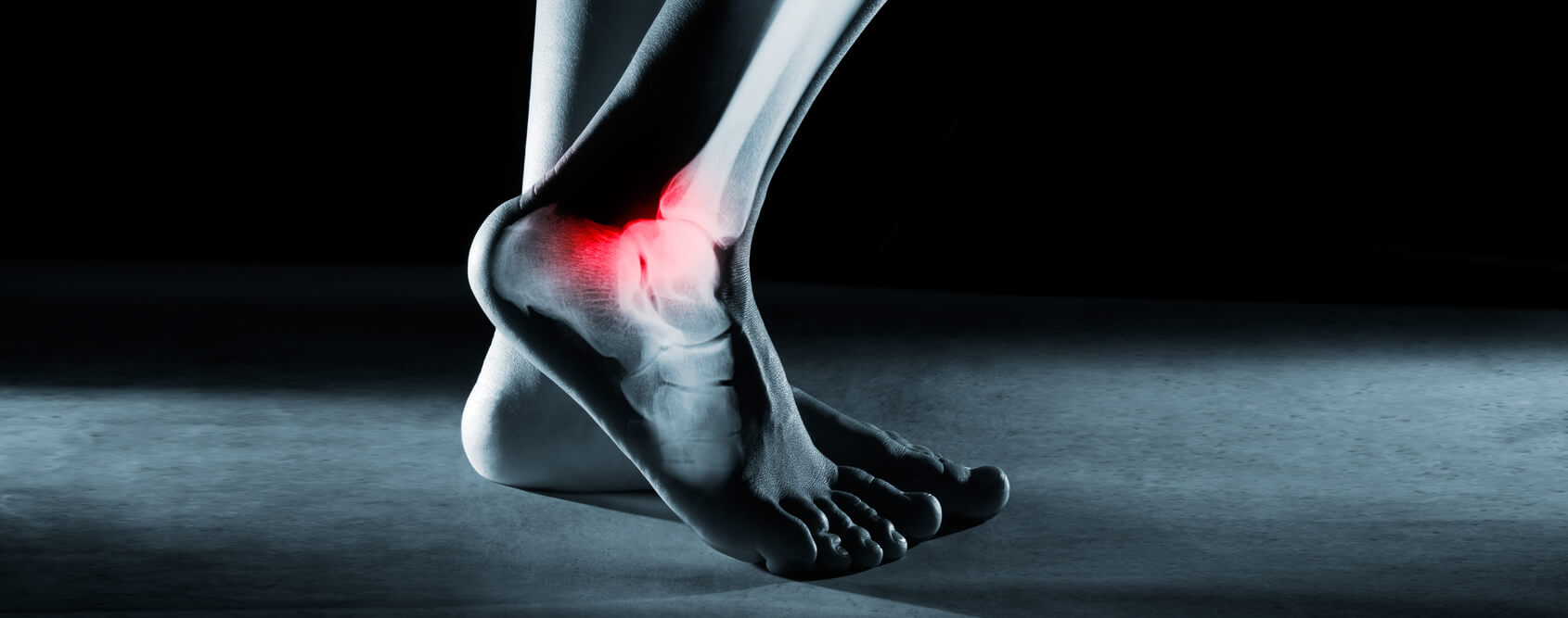 Podiatry Clinic Podiatrist Northcote - Ankle and Foot Pain Centre Northcote