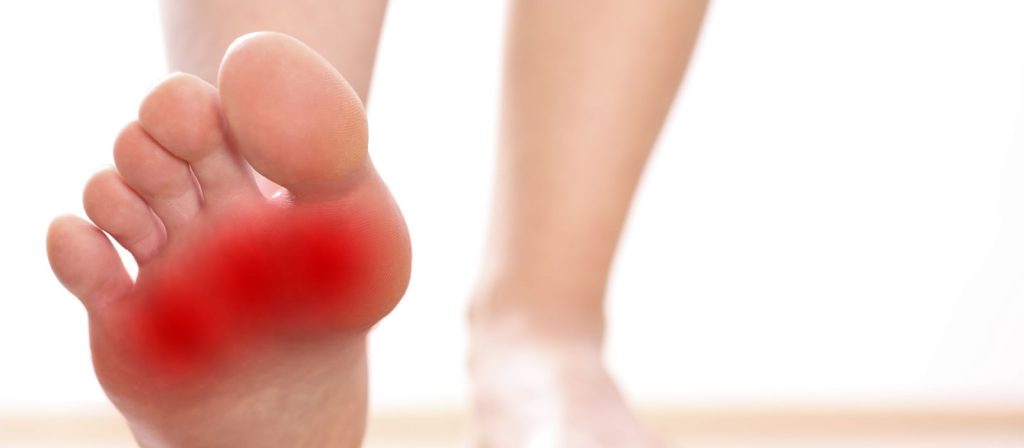 Intermetatarsal Bursitis - Ankle, Foot and Orthotic Centre