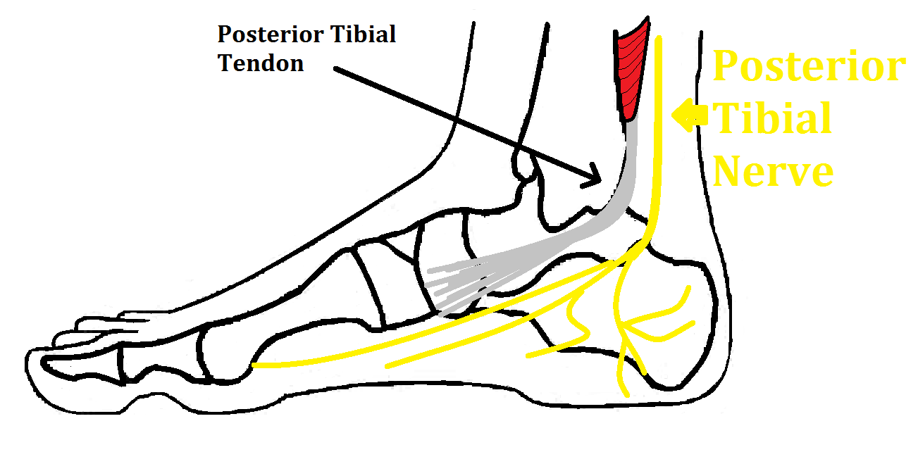 Tarsal Tunnel Syndrome Posterior Tibial Neuralgia Ankle Foot And