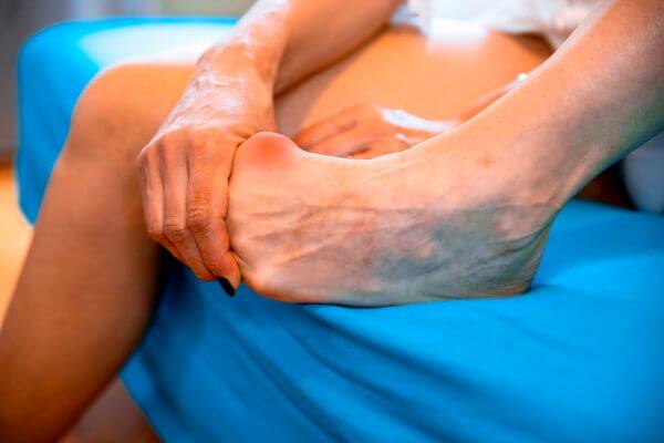 Bunion Surgery Northcote