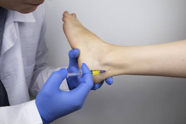 Cortisone Injections in Podiatry