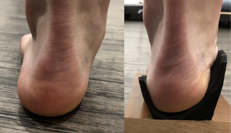 DHC orthotic flat feet Northcote