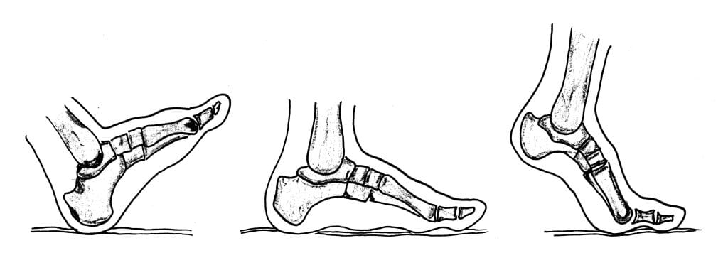 Normal Gait Phases Bones