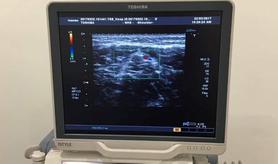 Ultrasound Imaging Northcote