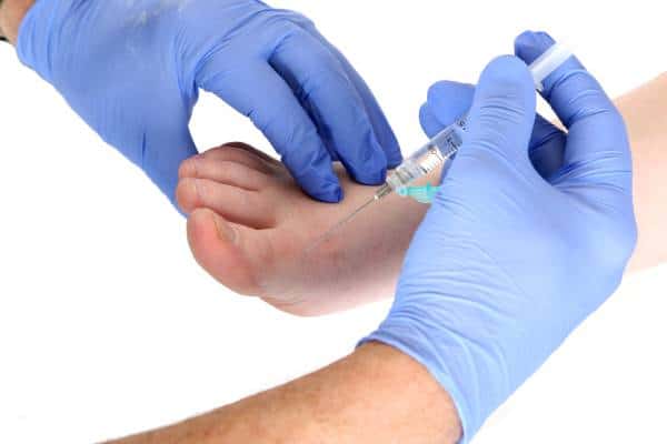 Injection Therapy - Ankle Foot and Orthotic Centre