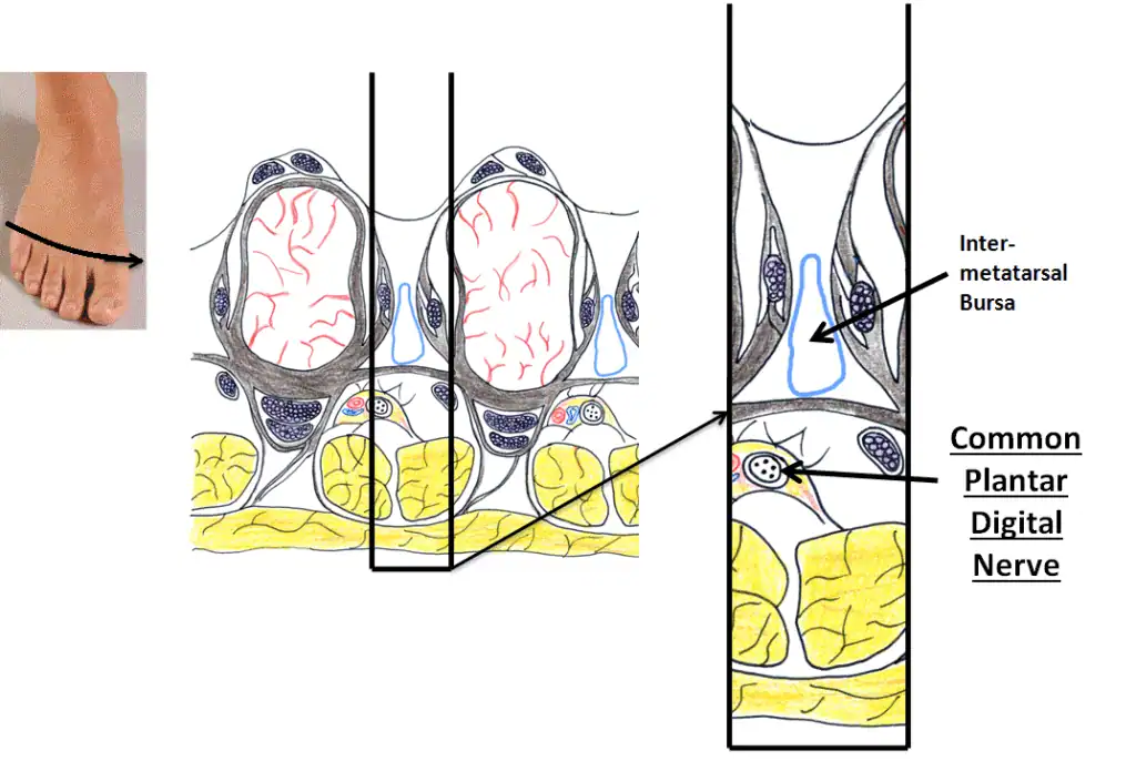 Common plantar digital nerve